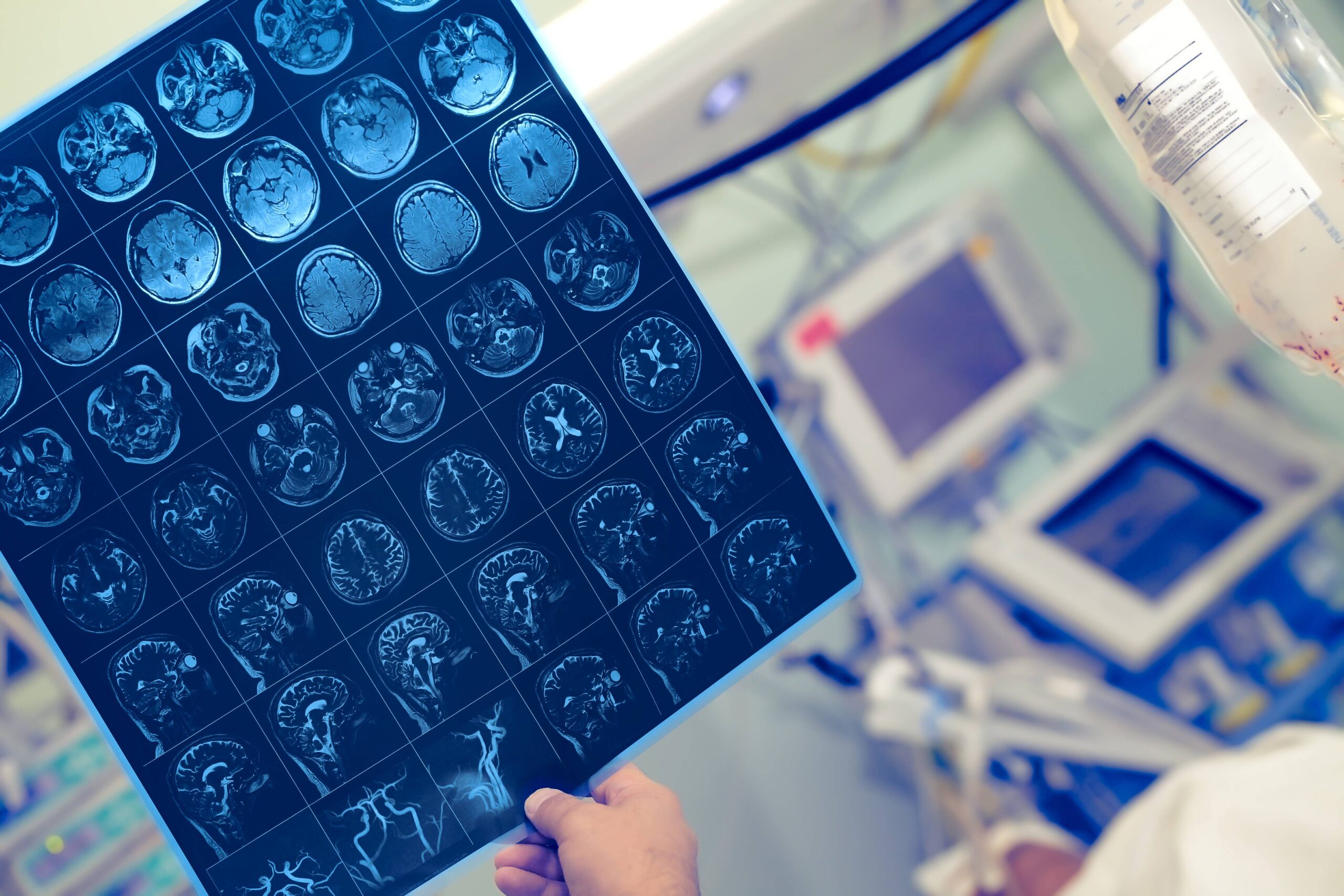 What is an acquired brain injury?