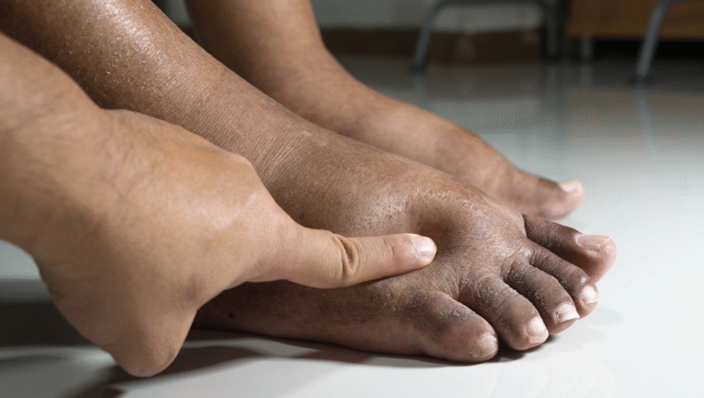 common foot problems in older adults 5